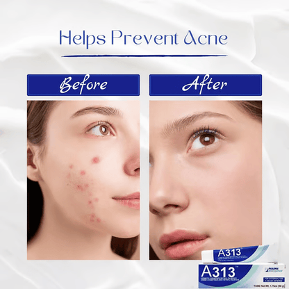 ✨ Get Clear, Radiant Skin Fast - 49% OFF- ✨ Ultimate A313 + HA Skincare Duo - For All Ages